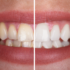 dental garden stomatolog bydgoszcz wybielanie zebow biale zeby